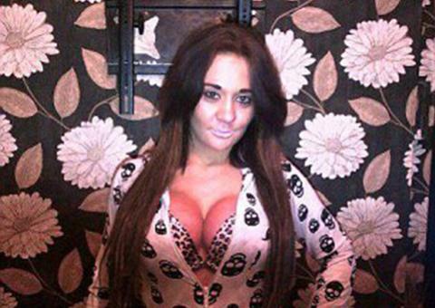 Modelo de 22 anos consegue silicone pago pelo governo